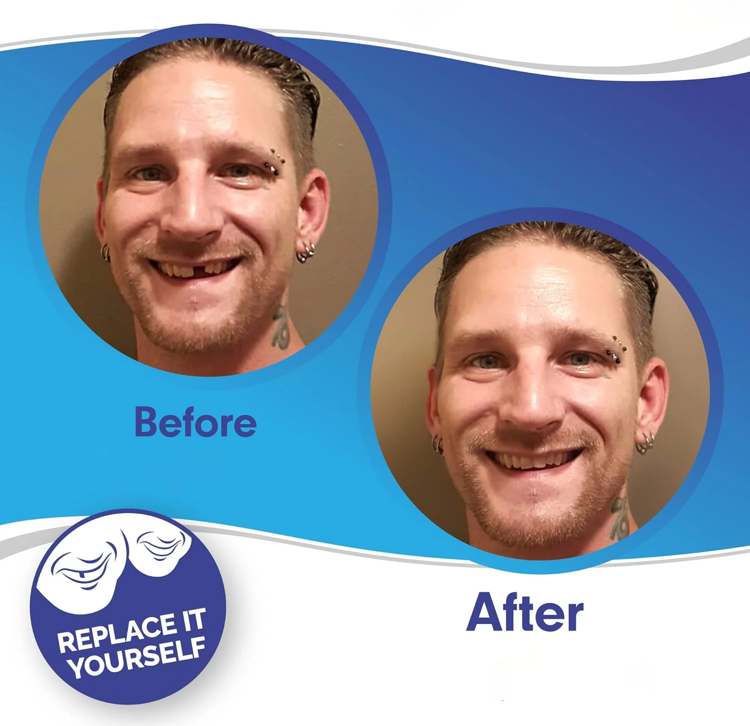Instant Smile Clip-On Veneers Kit