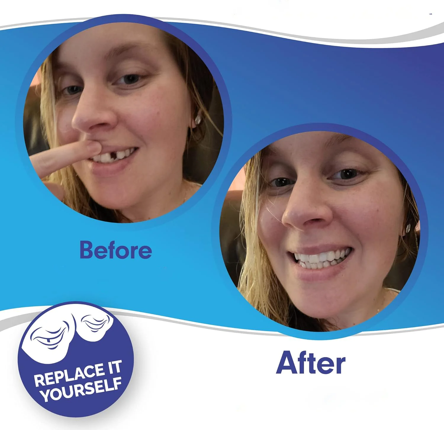 Instant Smile Clip-On Veneers Kit