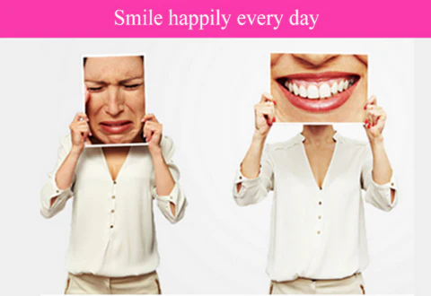 Instant Smile Clip-On Veneers Kit