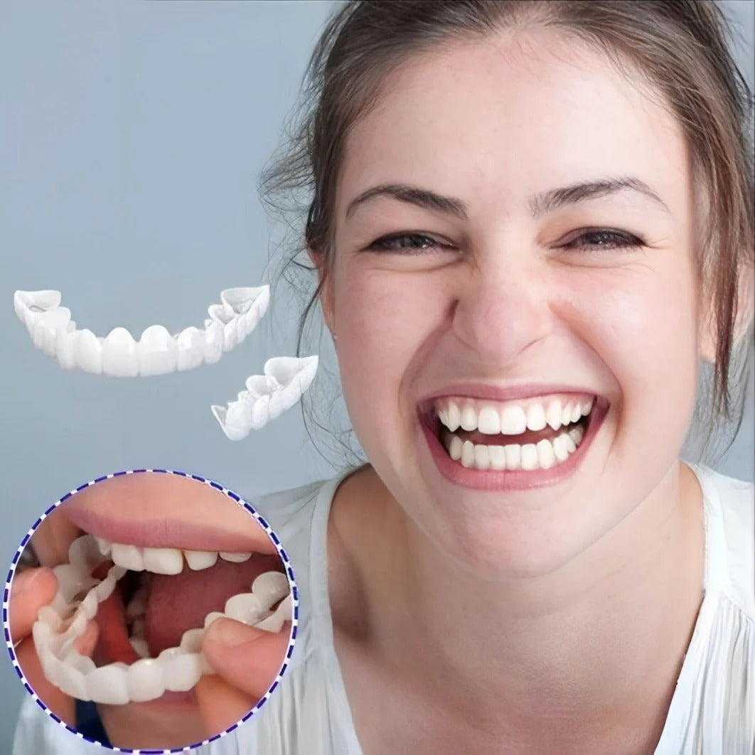 Instant Smile Clip-On Veneers Kit