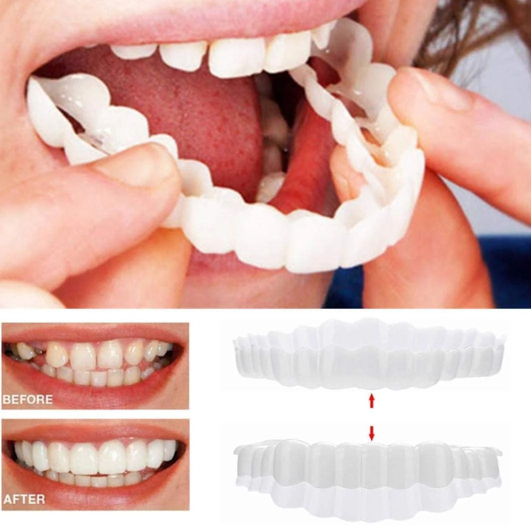 Instant Smile Clip-On Veneers Kit